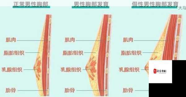 男性如何科学消除胸部脂肪堆积？应对策略解析